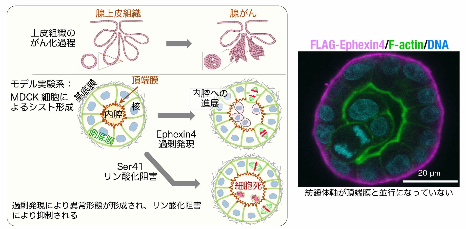 シスト形成の顕微鏡像